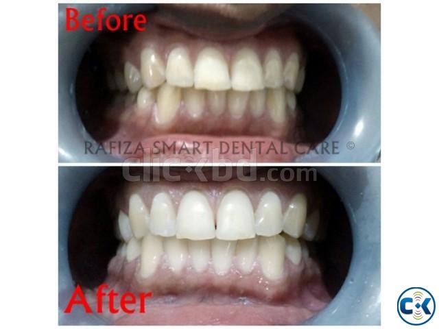 Best Dental Treatment at Lower Cost large image 0