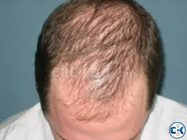 Hair Growth by homeo shampoo large image 0