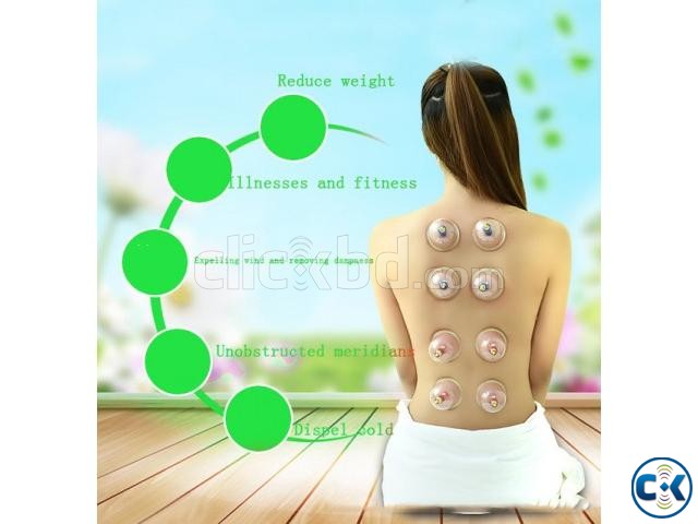 Vacuum Cupping Health Massage Therapy large image 0