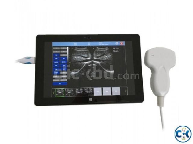 USB Laptop Ultrasound Scanner large image 0