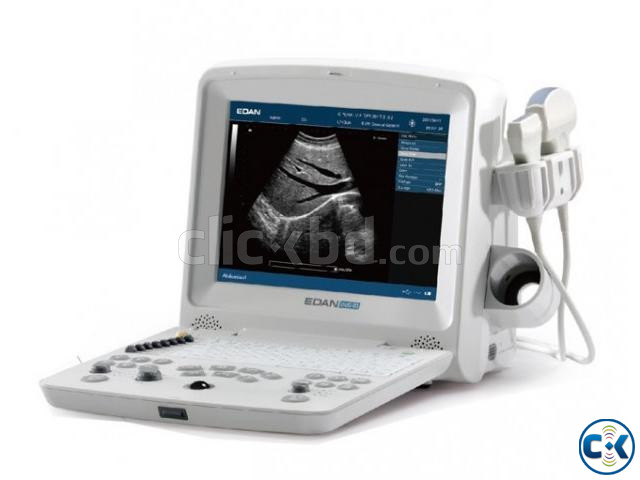 EDAN DUS 60 Digital Ultrasonic Diagnostic Imaging System large image 0