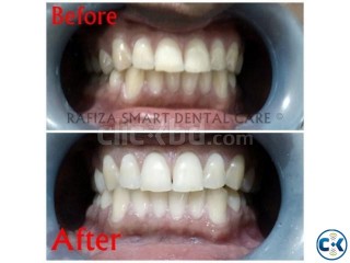Best Dental Treatment at Lower Cost