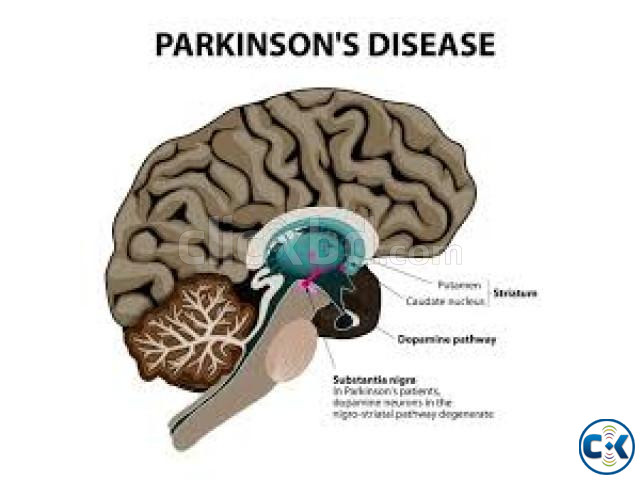 Perkinson diseases controlling course For male Female Si | ClickBD large image 0
